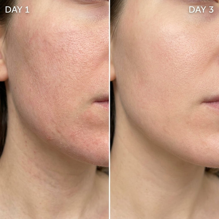 Visible results in as little as 3 days